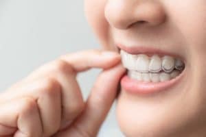 Is Invisalign Right for You