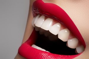 cleveland teeth whitening 