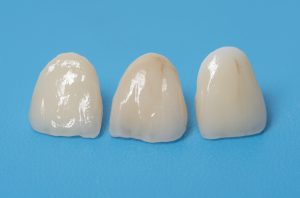 cleveland dental crowns cerec