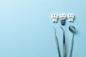 cleveland dental implants