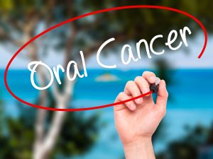 cleveland oral cancer screening