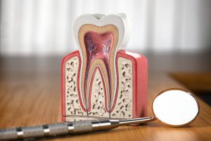 cleveland root canal