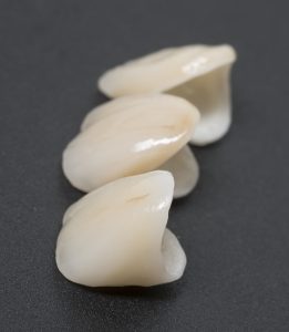 cleveland dental crowns