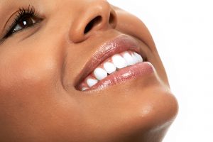 cleveland teeth whitening 