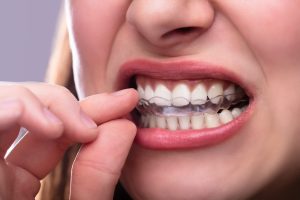 cleveland bruxism