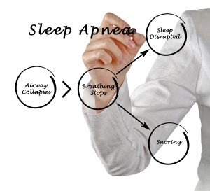 cleveland treating sleep apnea