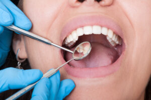 Cleveland, tx, dentist offers checkups and cleanings for patients 